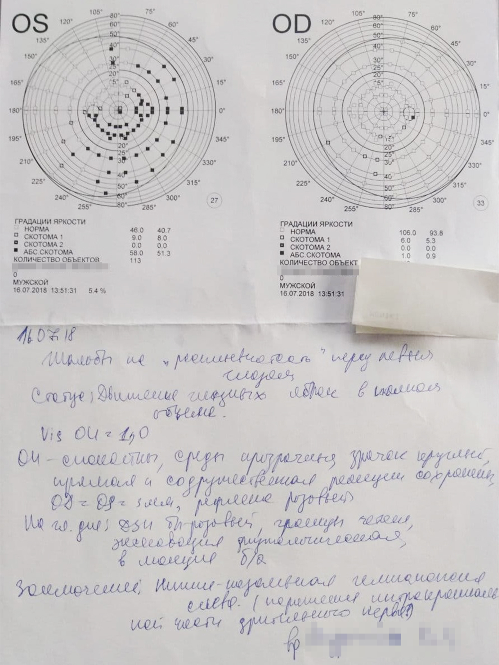 Выписка от офтальмолога, который меня обследовал