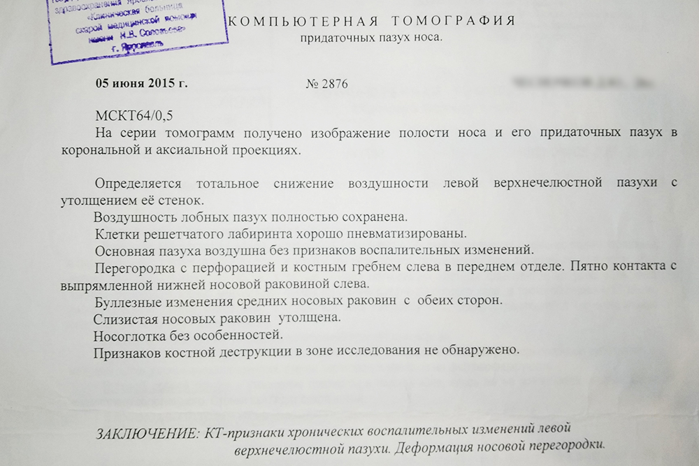 Врач увидел на снимке деформацию носовой перегородки и хроническое воспаление в левой верхнечелюстной пазухе носа