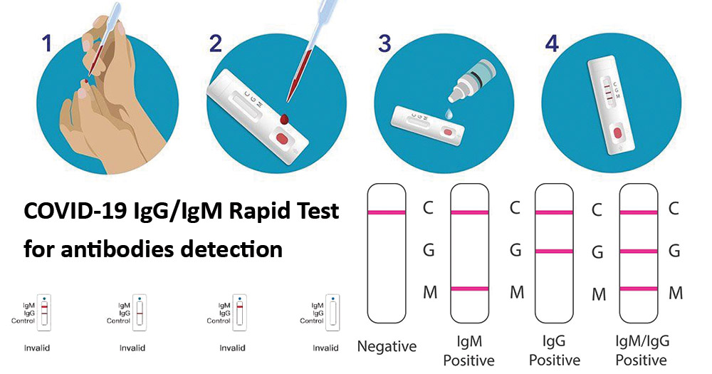 Определение антител IgM и IgG к коронавирусу SARS⁠-⁠CoV⁠-⁠2