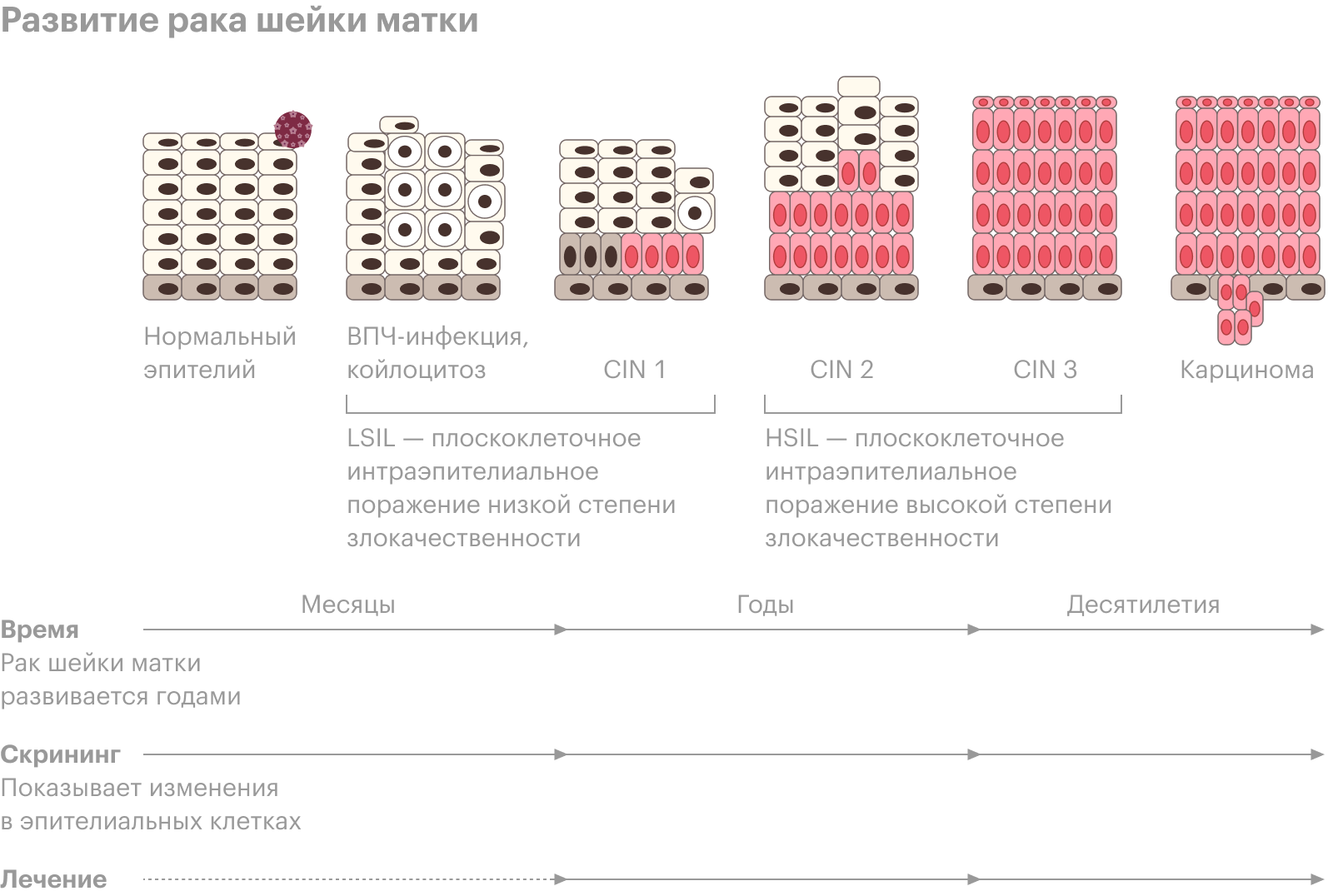 Рак шейки матки развивается годами, и это отражает цитологический анализ. Источник: «Рак-инфо»