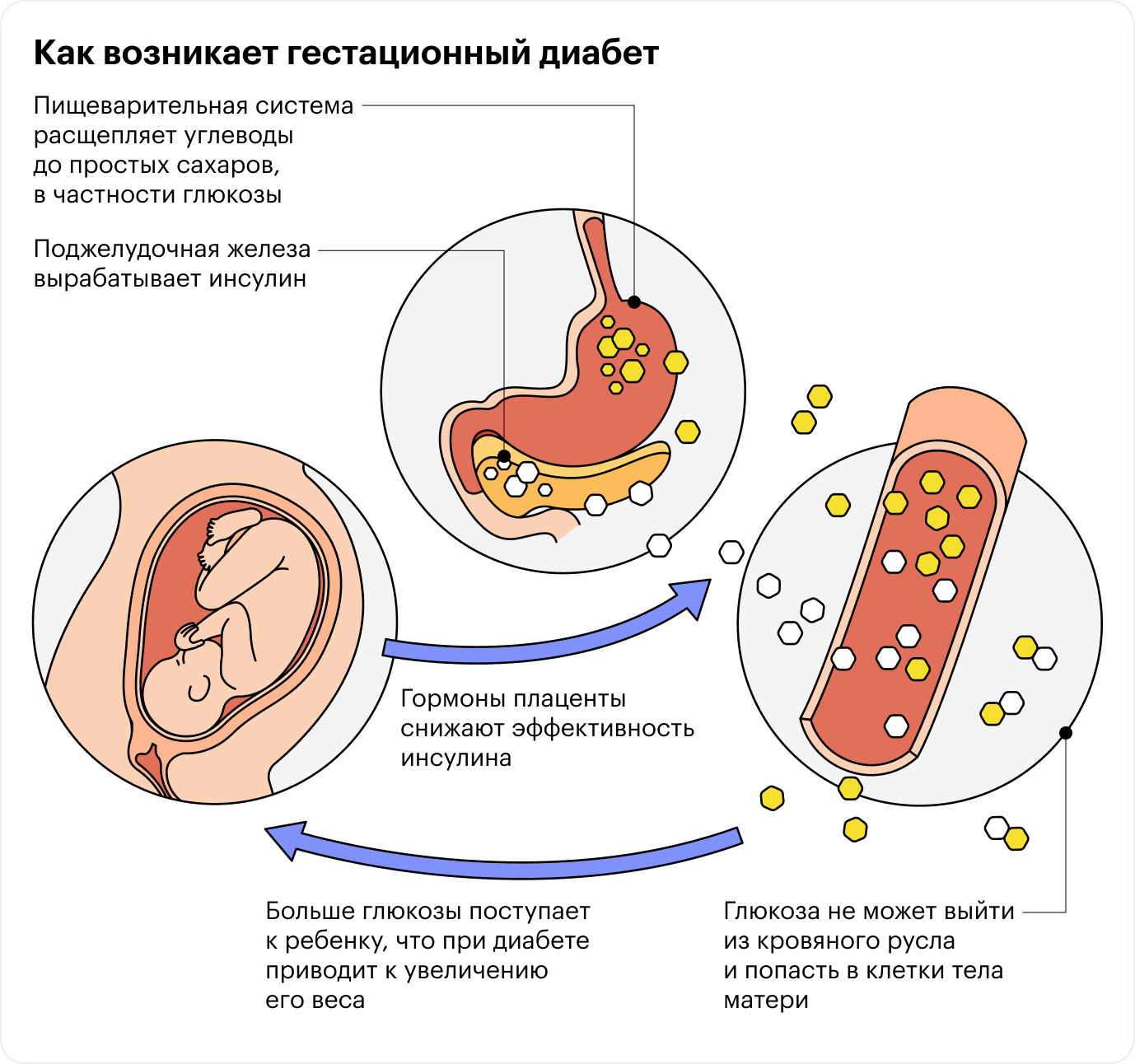 Гормоны плаценты препятствуют работе инсулина, и больше глюкозы поступает к ребенку