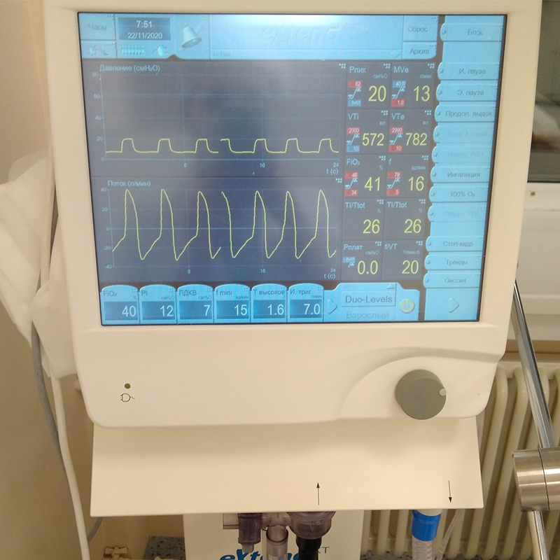 Аппараты ИВЛ я всегда фотографирую, чтобы параметры вентиляции были под рукой