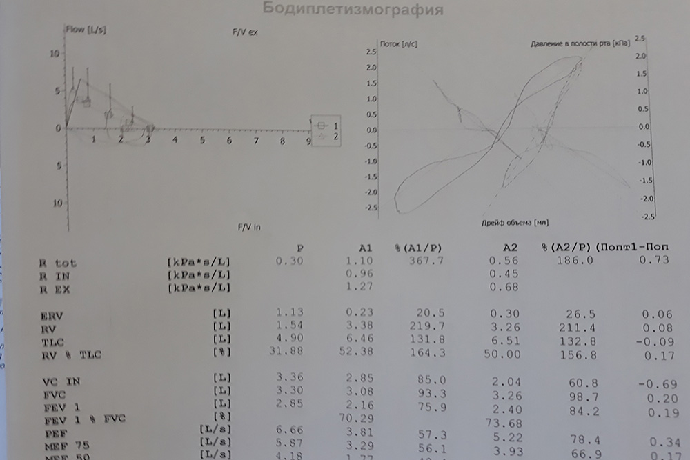 Так выглядит протокол бодиплетизмографии