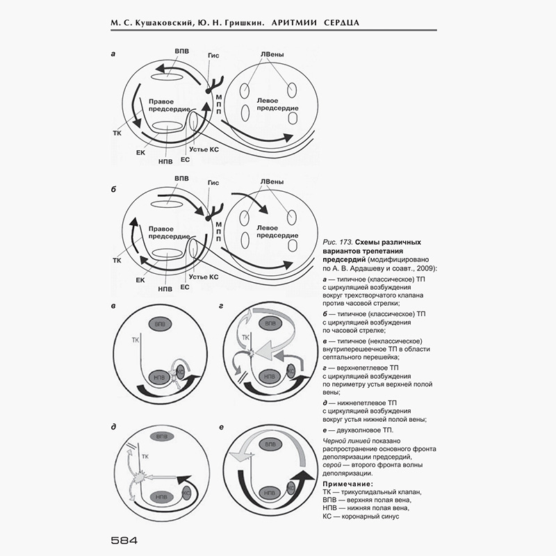 Учебник не помог разрешить спор о трепетании предсердий