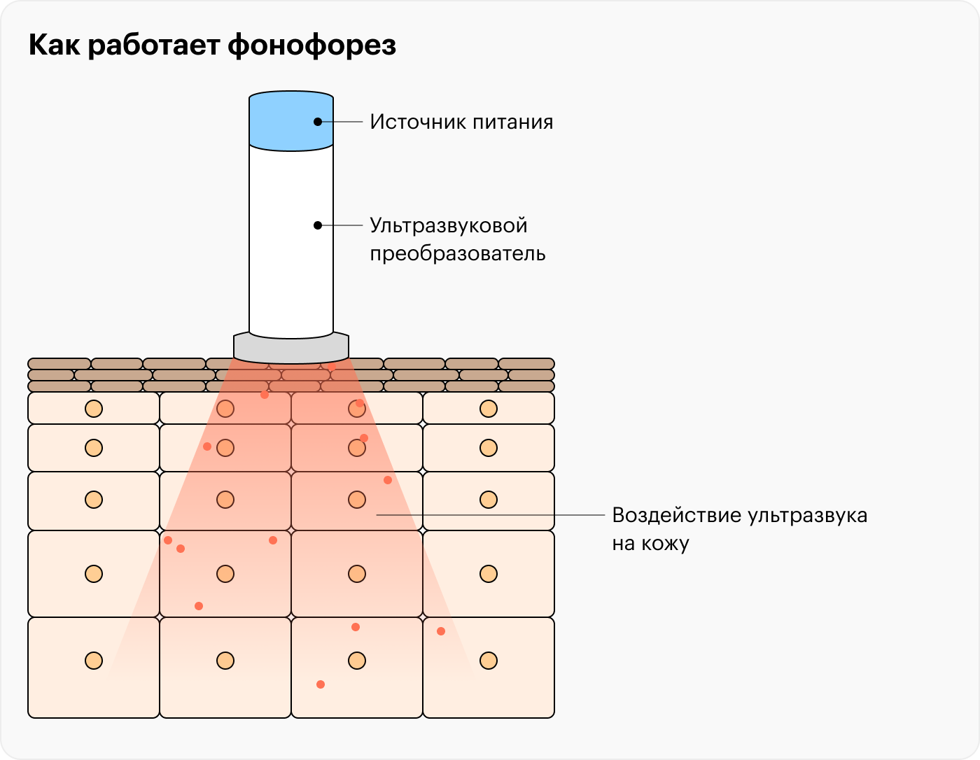 Ультразвук проходит через датчик в кожу. Возможно, он заставляет пузырьки газов расталкивать клетки эпидермиса, делая кожу более проницаемой для лекарств