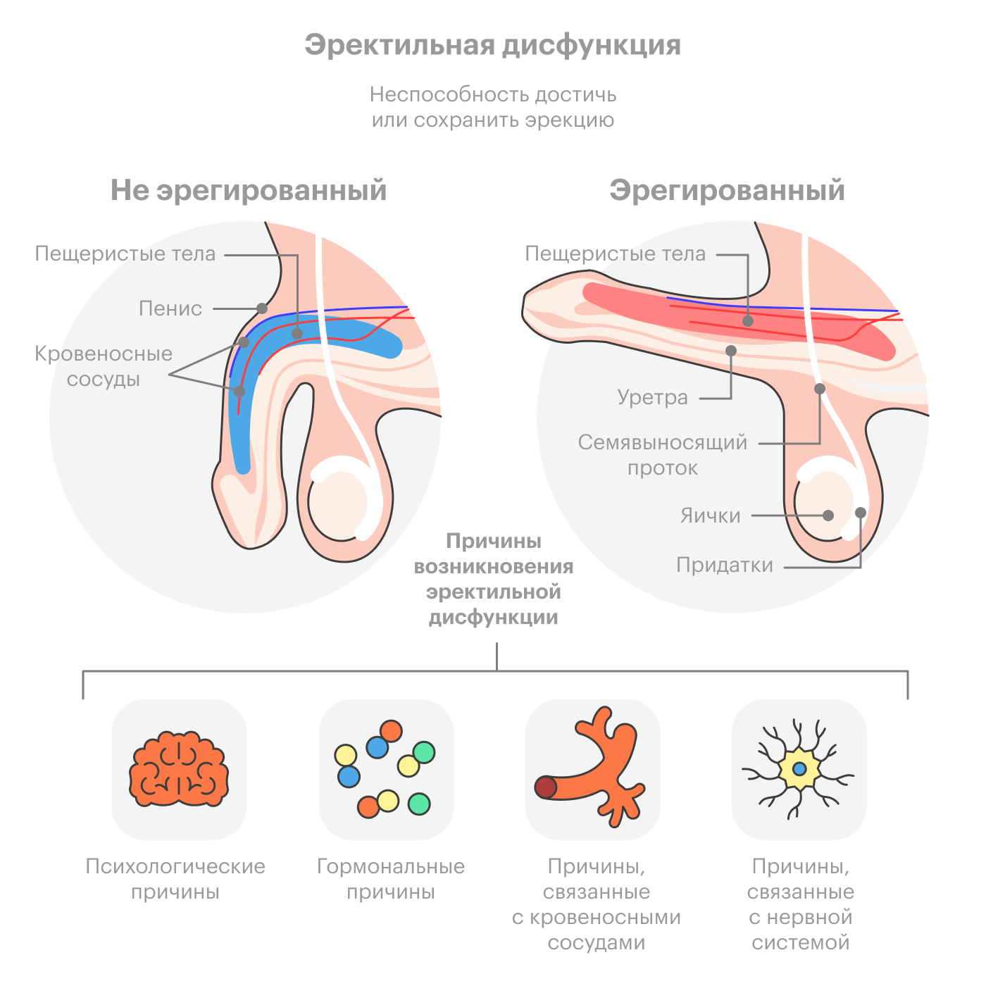 Как правило, эректильная дисфункция связана с психогенными причинами, гормональными, сосудистыми или нейронными нарушениями — или вызвана сразу несколькими факторами