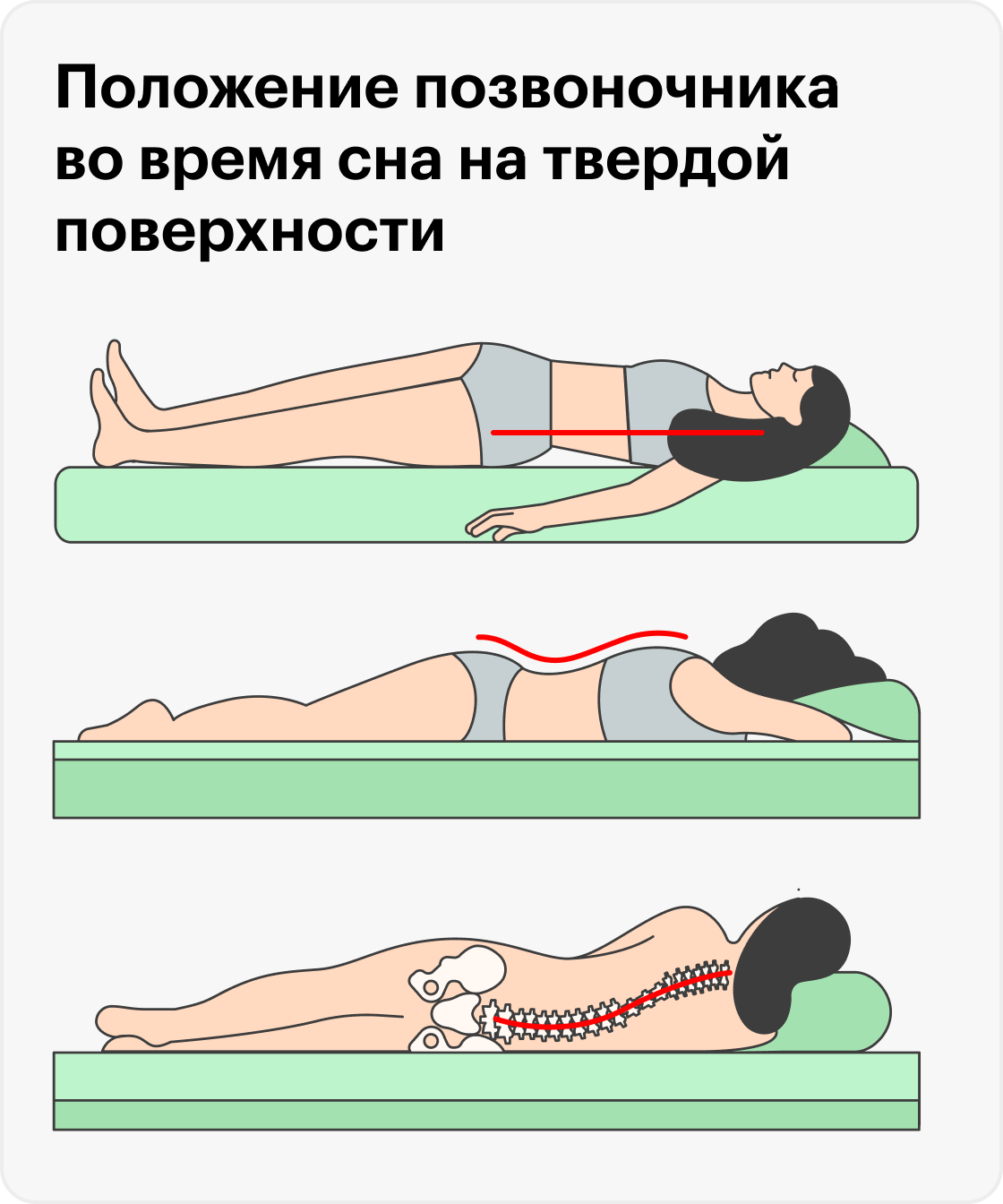 Твердый матрас: тело лежит на его поверхности и позвоночник снова отклоняется от оптимального положения