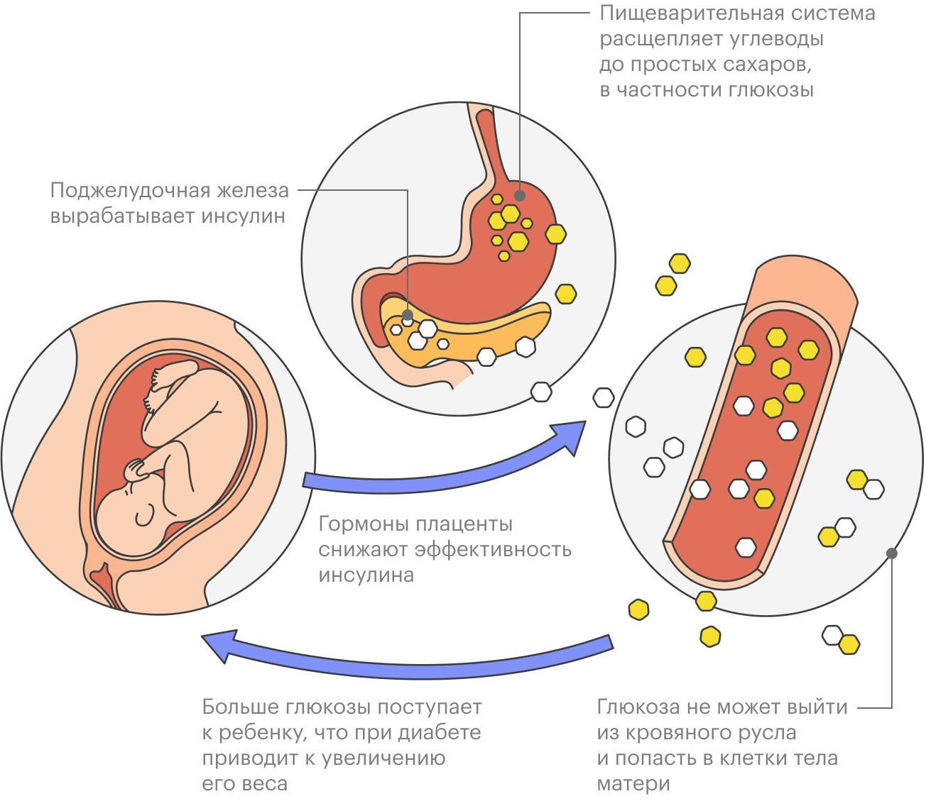 Гормоны плаценты препятствуют работе инсулина, и больше глюкозы поступает к ребенку