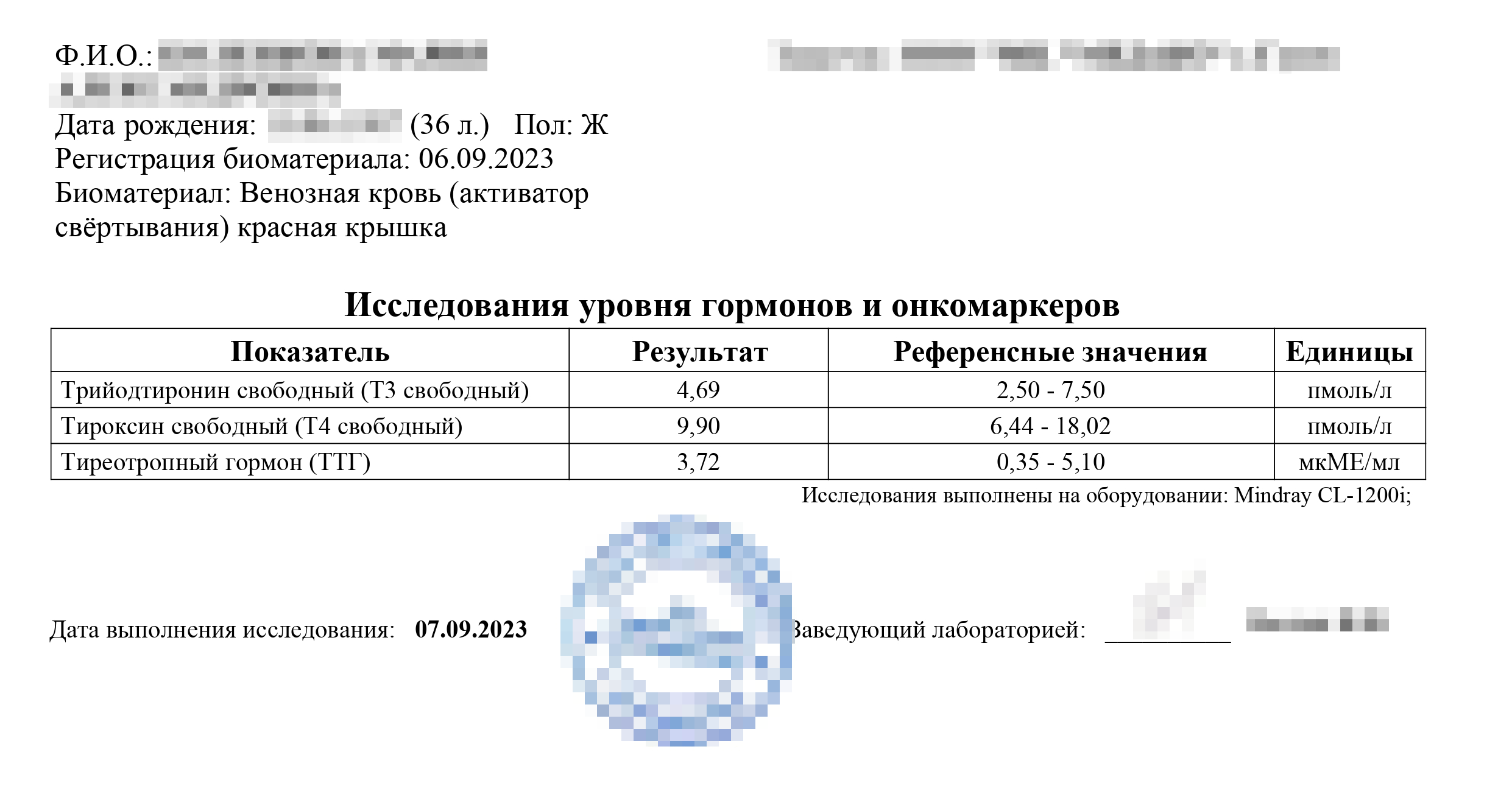 Накануне радиойодтерапии я находилась в так называемом «медикаментозном эутиреозе». При нем из⁠-⁠за приема таблеток гормоны приходят в норму, но диффузный токсический зоб все равно никуда не девается