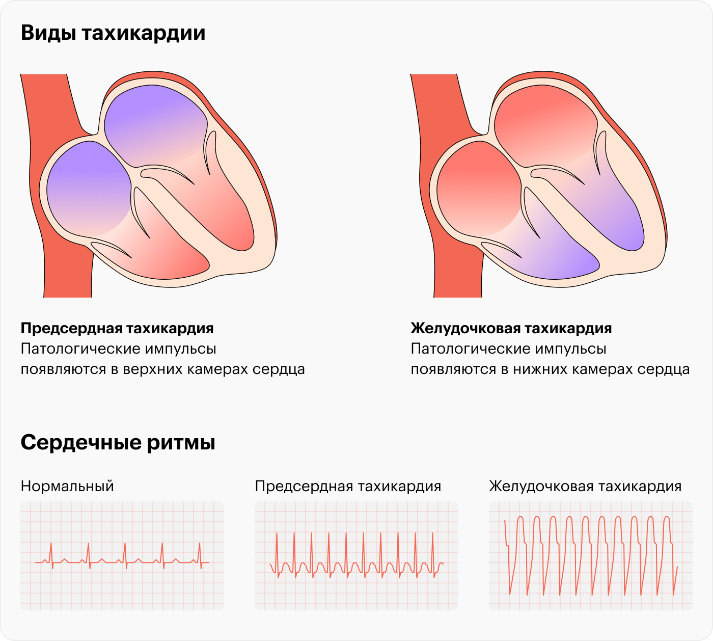 Источник: mayoclinic.org