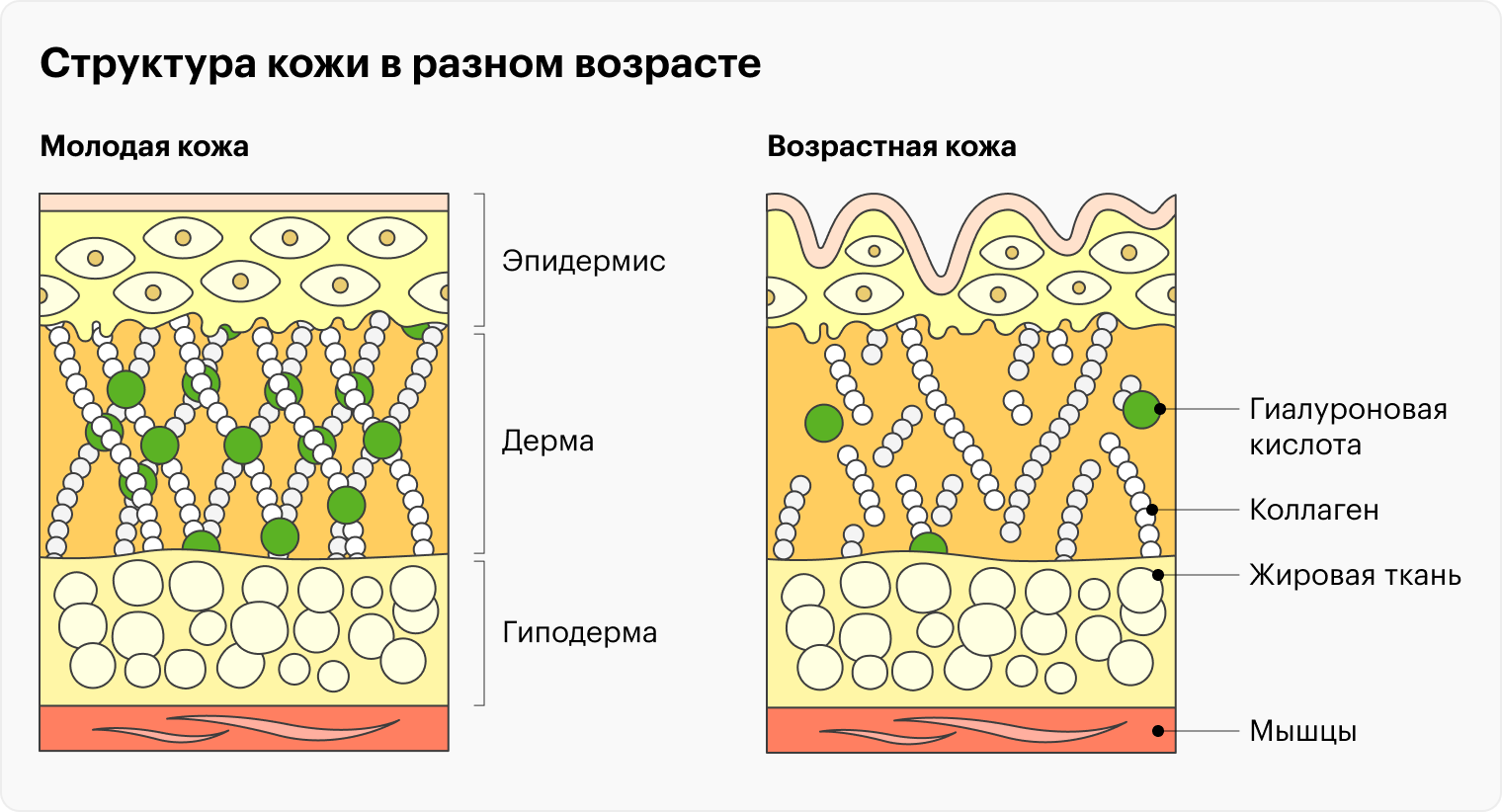 В молодой коже много коллагена, эластина и длинноцепочечной гиалуроновой кислоты, поэтому она упругая, эластичная и объемная. С возрастом количество этих компонентов в коже уменьшается и на ней появляются морщины