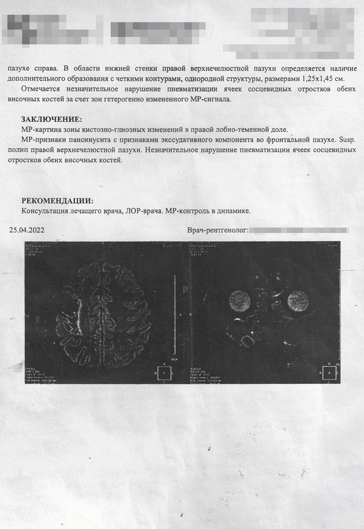 Результаты последней МРТ