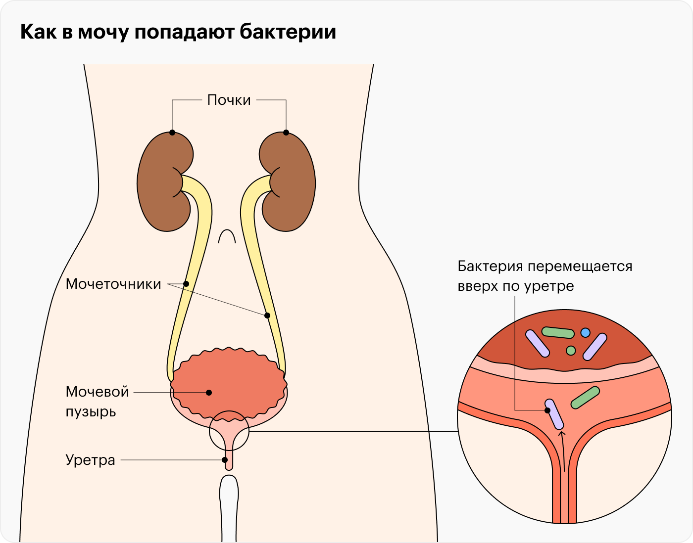 В почках и мочеточниках моча стерильна. Бактерии в нее попадают в мочевом пузыре, а там они оказываются, когда перемещаются вверх по мочеиспускательному каналу