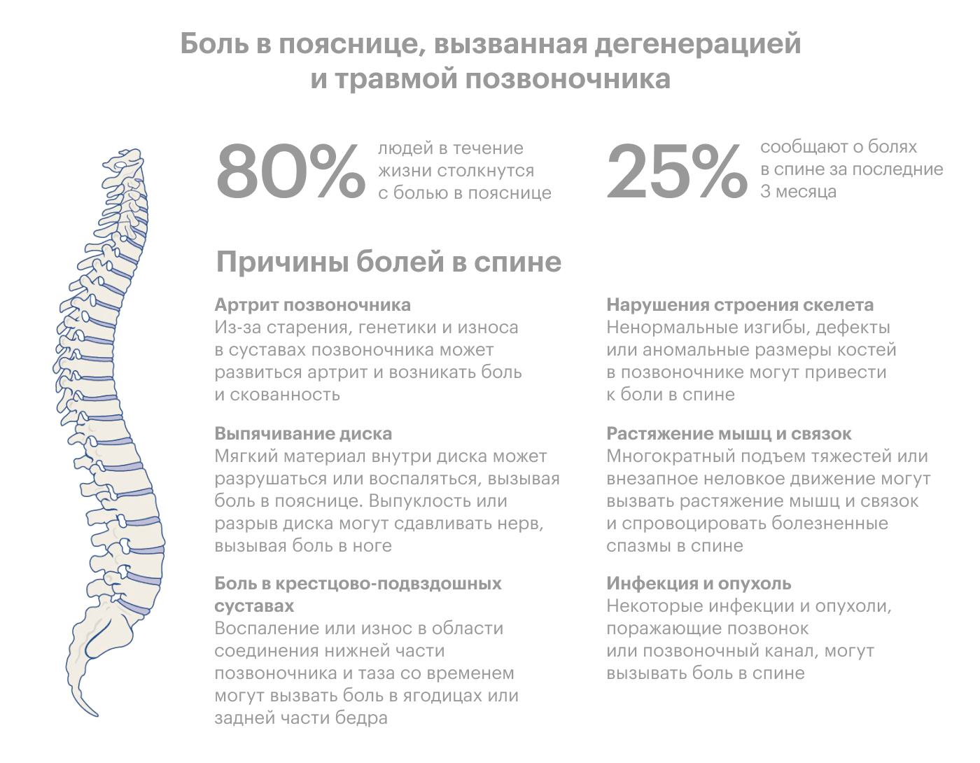 Основные причины болей в спине, по мнению сотрудников Клиники Майо