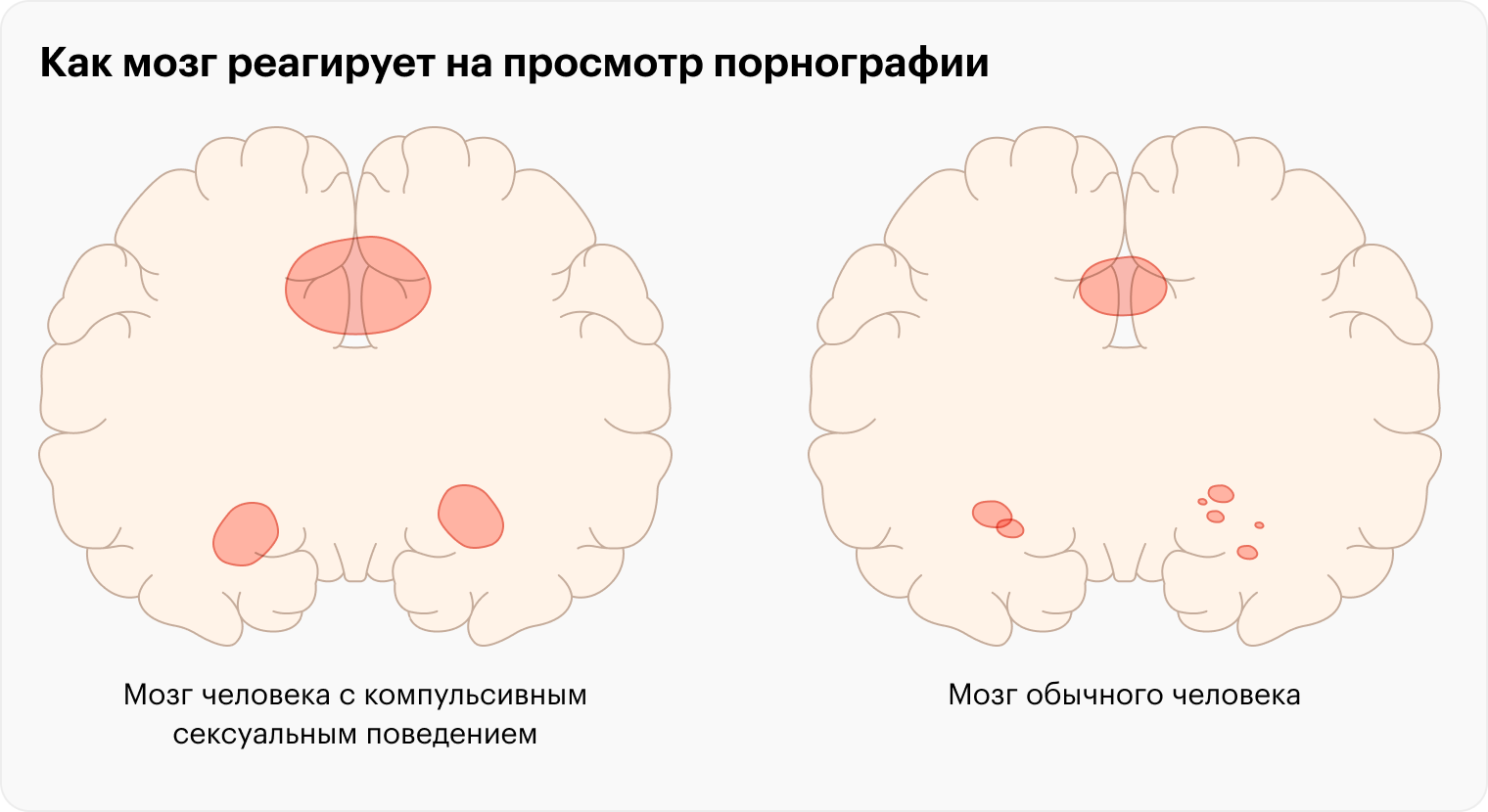 При просмотре порно мозг человека с компульсивным сексуальным поведением демонстрирует повышенную активность в правом вентральном полосатом теле, дорсальной передней поясной извилине и миндалине. Ранее ученые уже наблюдали подобную картину — у наркозависимых людей при виде наркотика. Источник: journals.plos.org