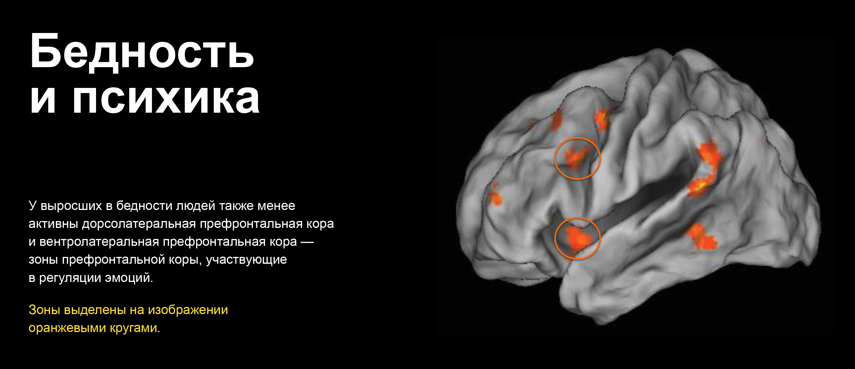 На изображении — дорсолатеральная префронтальная кора и вентролатеральная префронтальная кора, они обведены оранжевыми кругами. Это те зоны мозга, которые более пассивны у людей, выросших в бедности