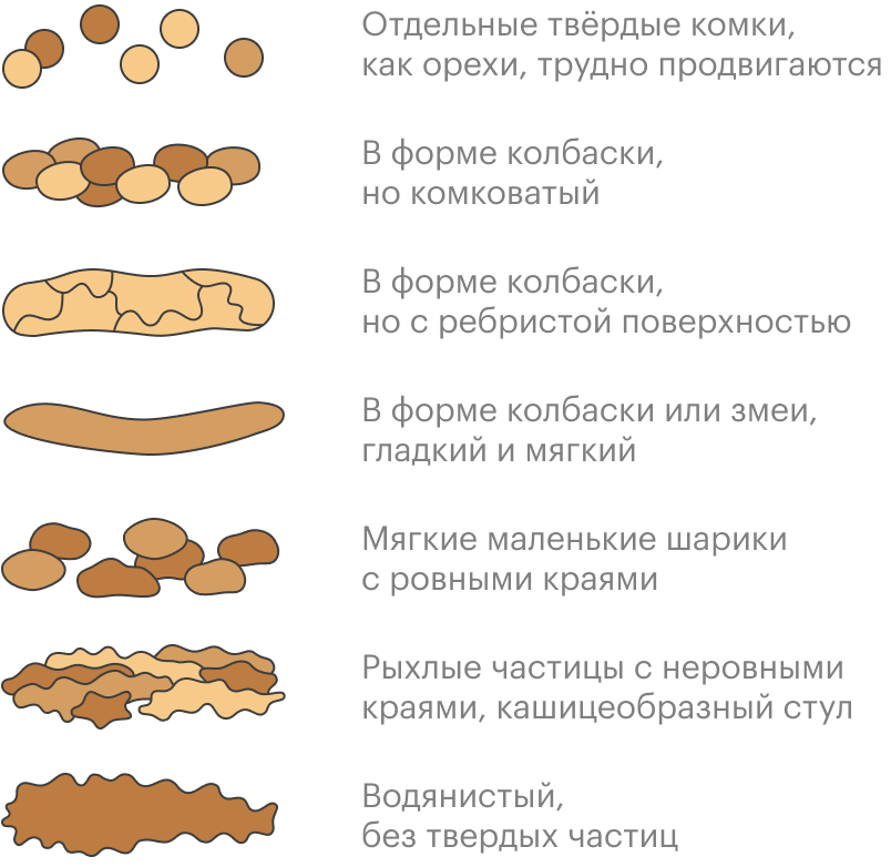 Постоянный твердый стул считается запором, даже если частота походов в туалет не меняется