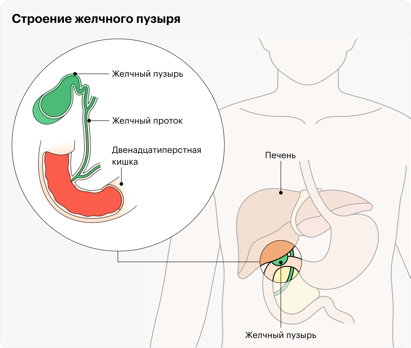 По желчному протоку желчь из пузыря попадает в пищеварительную систему. Если песок или камни перекрывают проток, желчь застаивается, в ней развивается воспаление. В одном из пяти случаев к воспалению присоединяется бактериальная инфекция