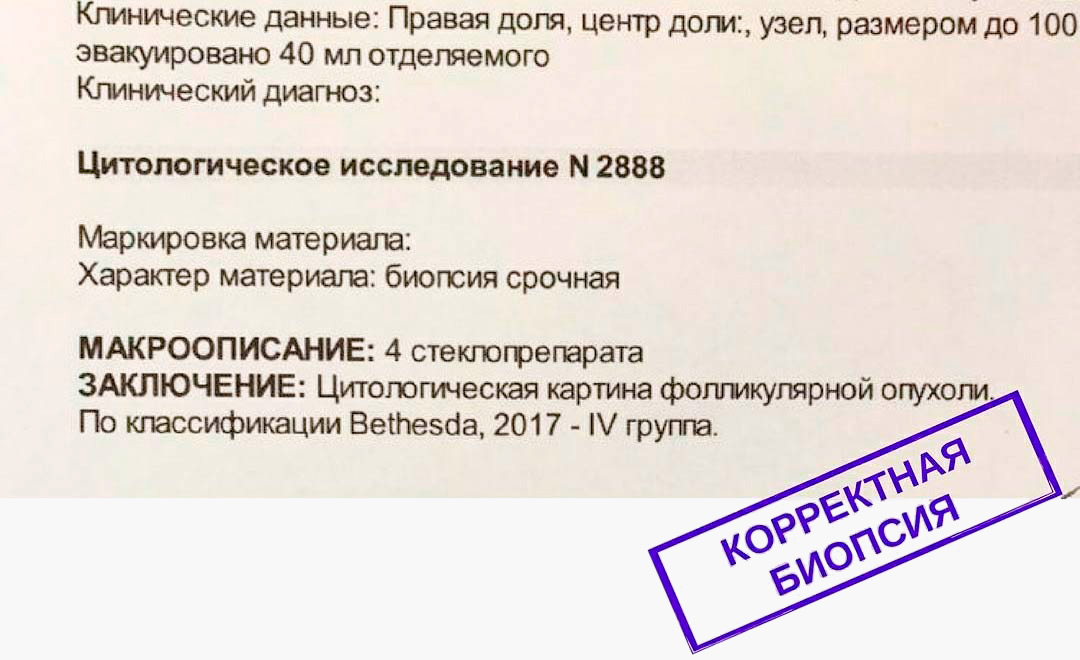 Врач дал заключение по системе Бетесда. Такое заключение смогут понять морфологи и хирурги по всему миру — оно стандартизировано