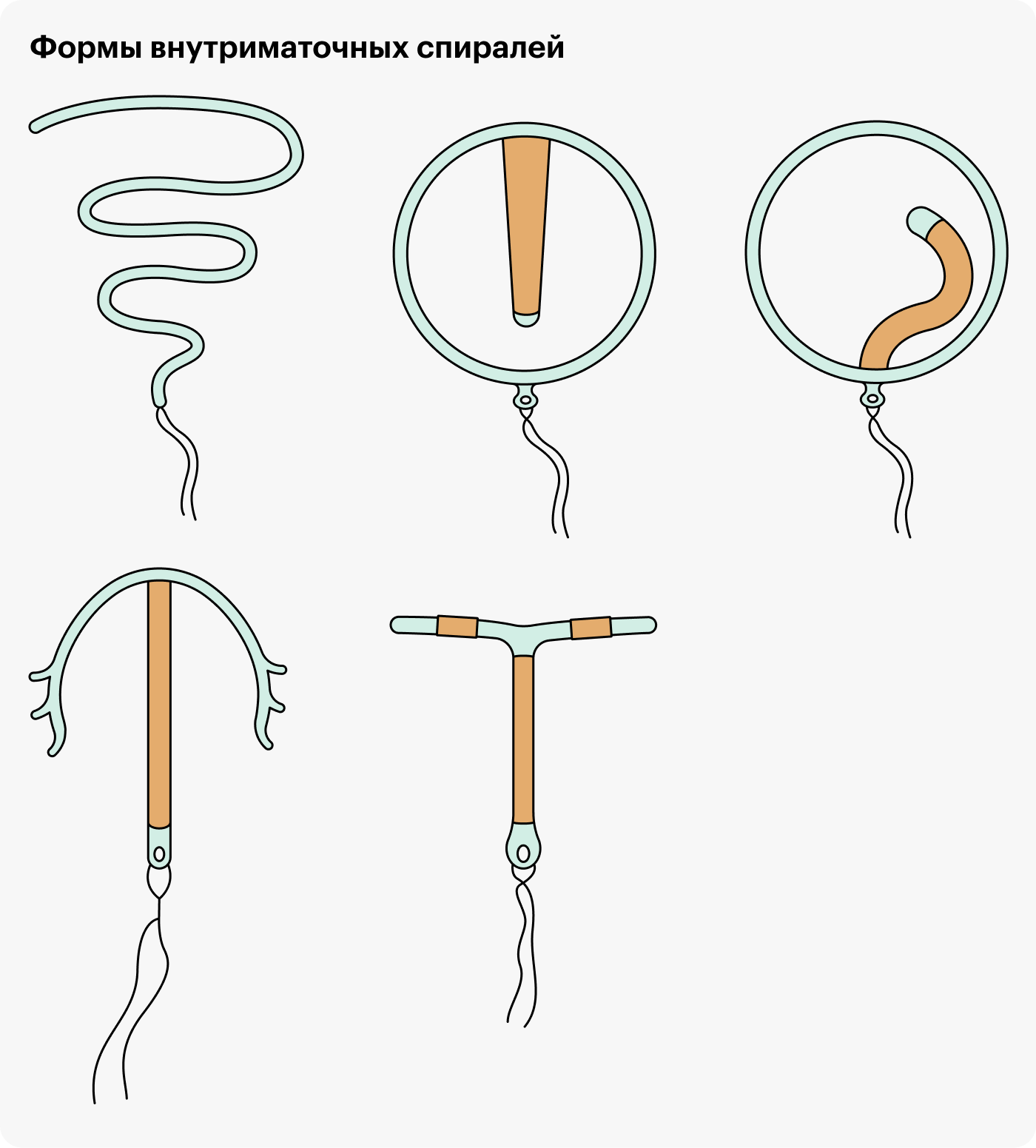 Внутриматочные спирали бывают разных форм, на эффективность и безопасность это не влияет
